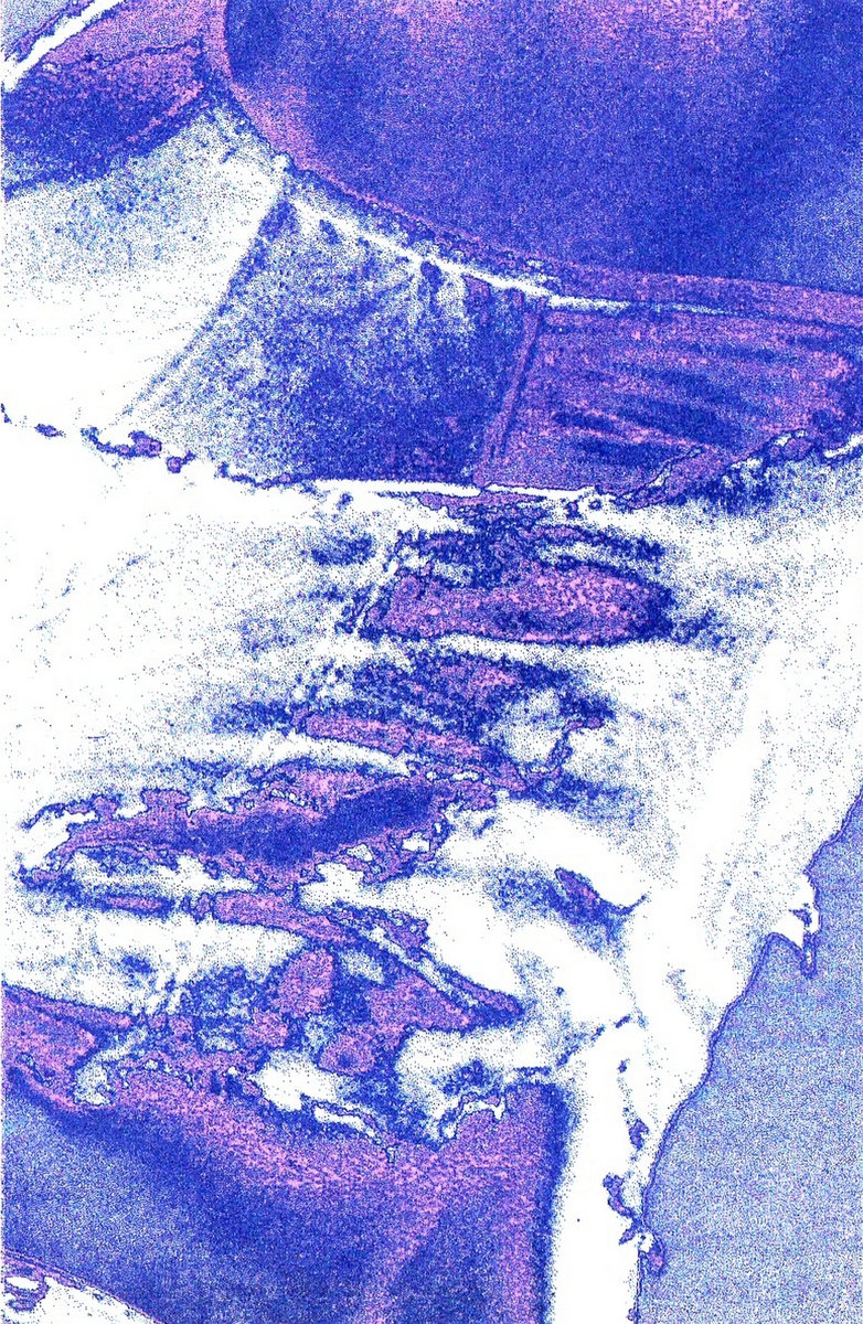 — Cosmo Remix —